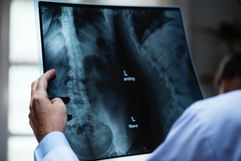 doctor looking at an x-ray